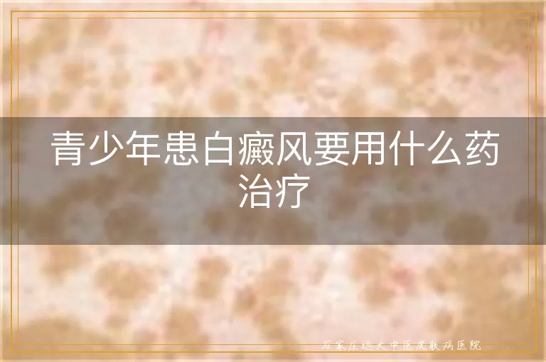 青少年患白癜风要用什么药治疗