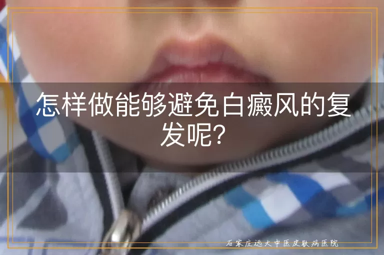 怎样做能够避免白癜风的复发呢？