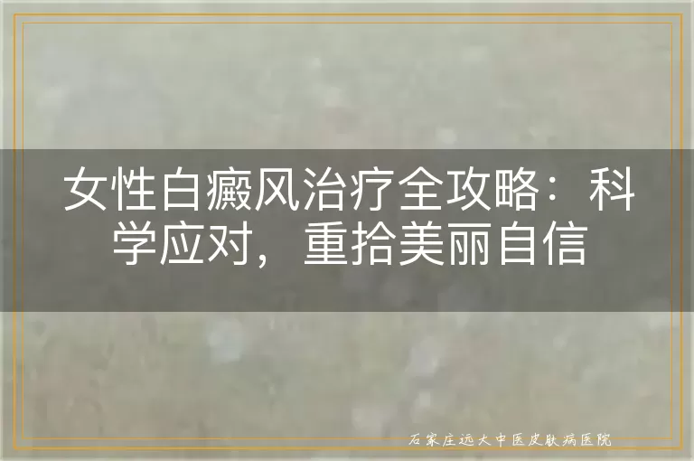 女性白癜风治疗全攻略：科学应对，重拾美丽自信
