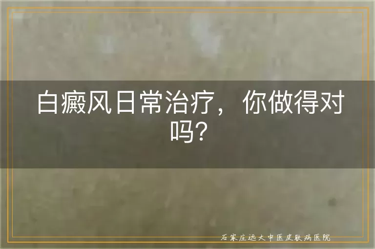 白癜风日常治疗，你做得对吗？