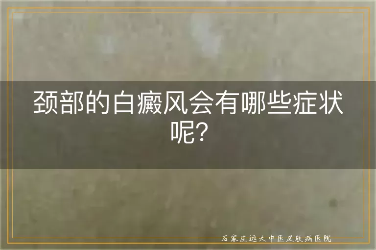 颈部的白癜风会有哪些症状呢？