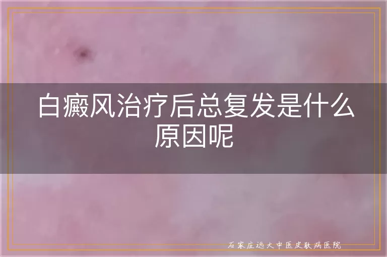 白癜风治疗后总复发是什么原因呢