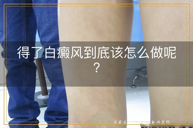 得了白癜风到底该怎么做呢？