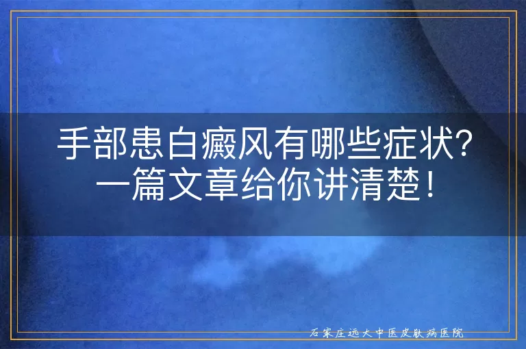 手部患白癜风有哪些症状？一篇文章给你讲清楚！