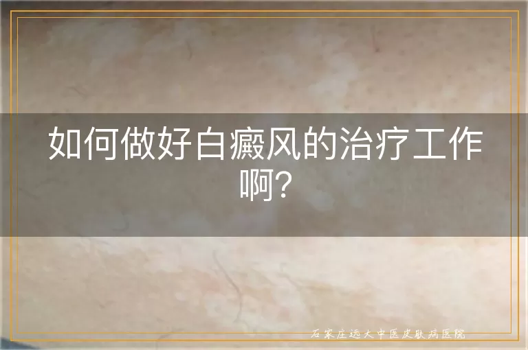 如何做好白癜风的治疗工作啊？