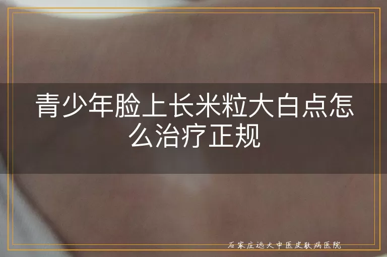 青少年脸上长米粒大白点怎么治疗正规