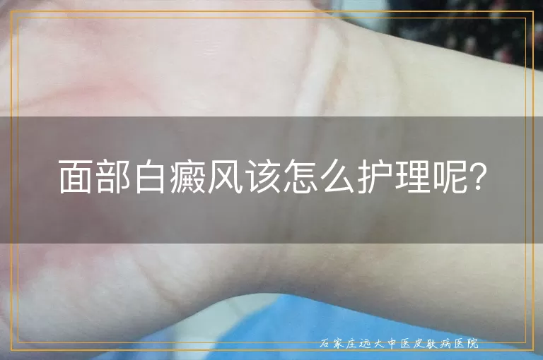 面部白癜风该怎么护理呢？