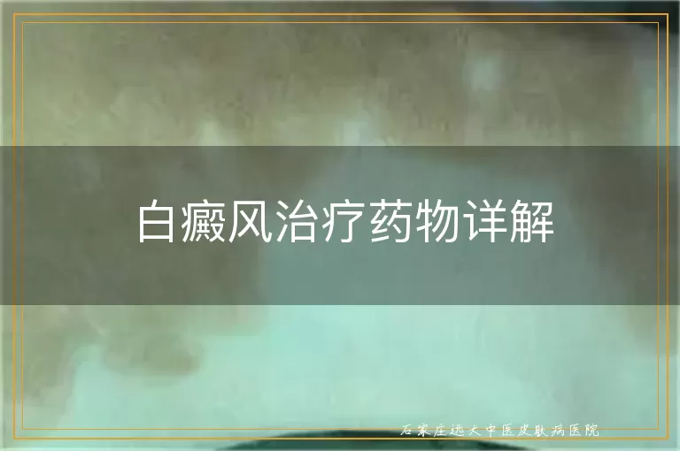 白癜风治疗药物详解