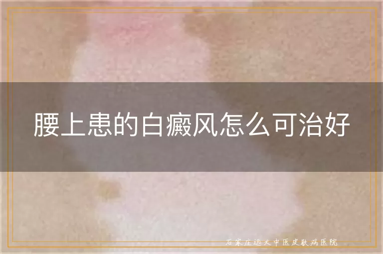腰上患的白癜风怎么可治好