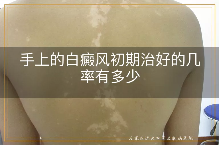 手上的白癜风初期治好的几率有多少