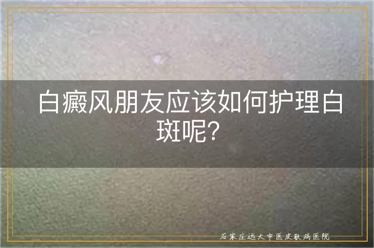 白癜风朋友应该如何护理白斑呢？