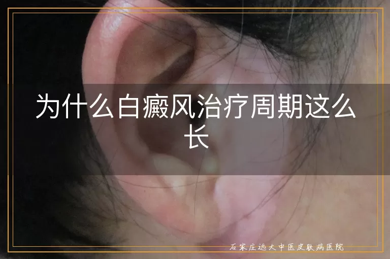 为什么白癜风治疗周期这么长