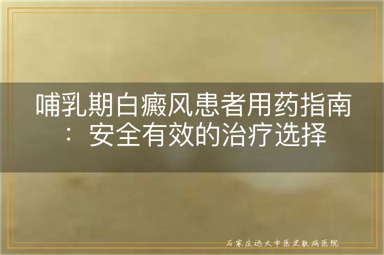 哺乳期白癜风患者用药指南：安全有效的治疗选择