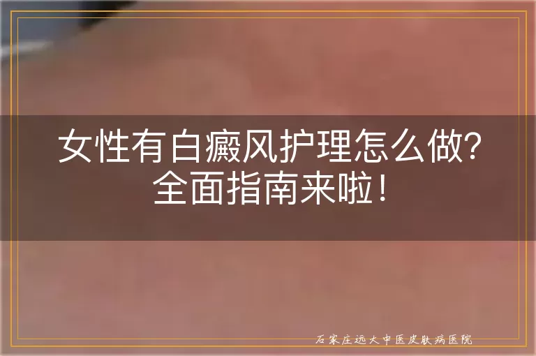 女性有白癜风护理怎么做？全面指南来啦！