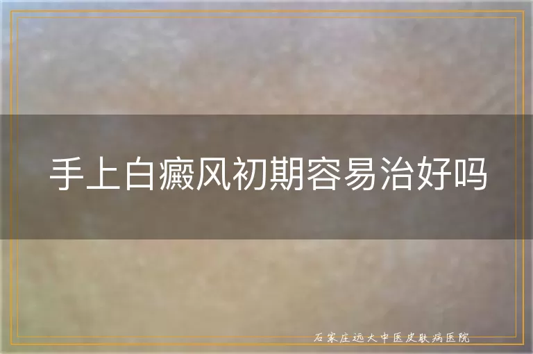手上白癜风初期容易治好吗