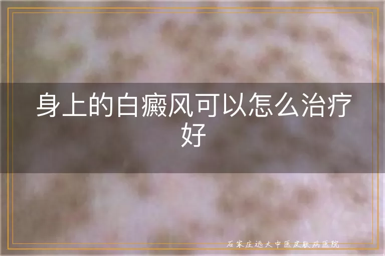 身上的白癜风可以怎么治疗好