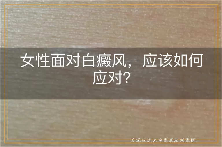 女性面对白癜风，应该如何应对？