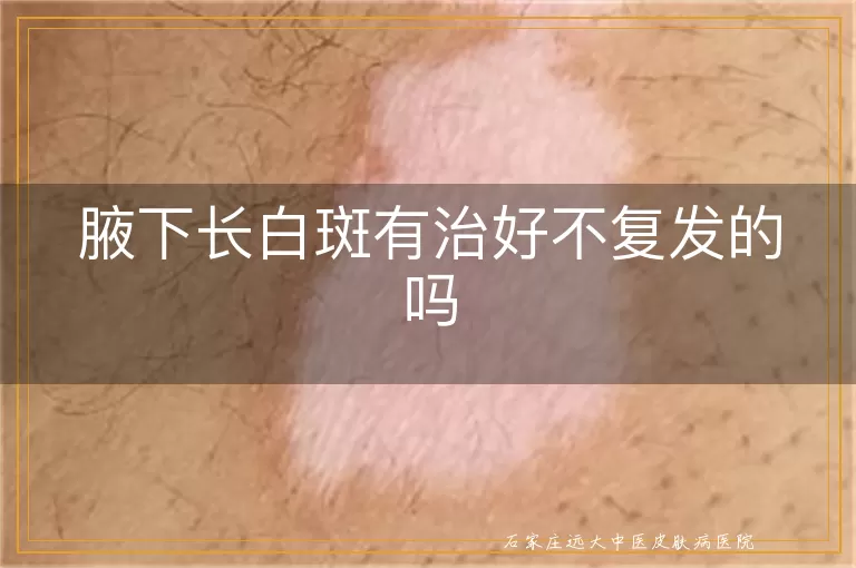 腋下长白斑有治好不复发的吗