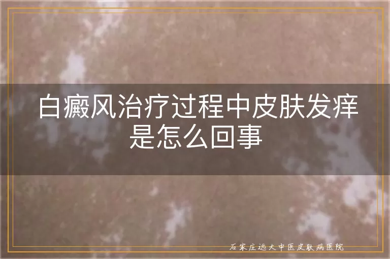 白癜风治疗过程中皮肤发痒是怎么回事