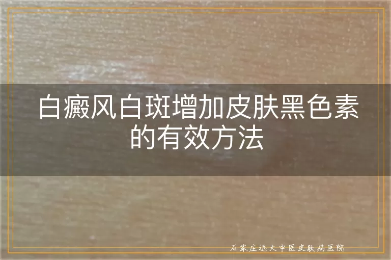 白癜风白斑增加皮肤黑色素的有效方法