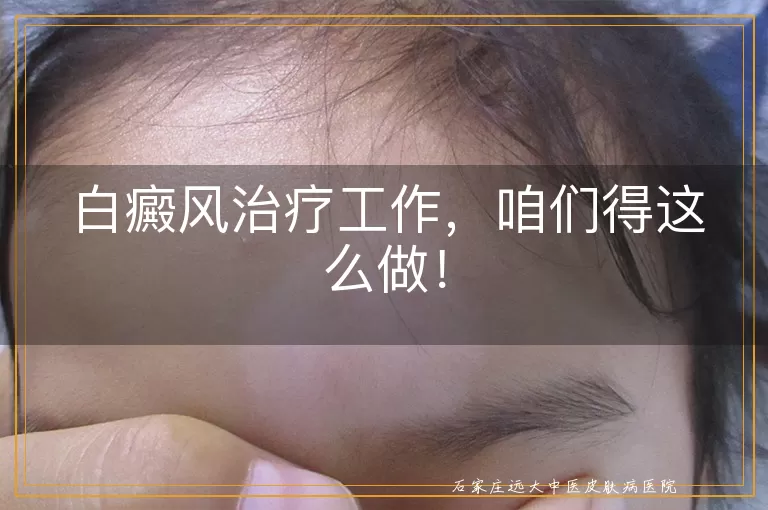 白癜风治疗工作，咱们得这么做！