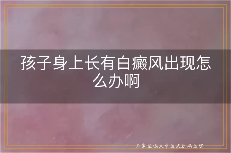 孩子身上长有白癜风出现怎么办啊