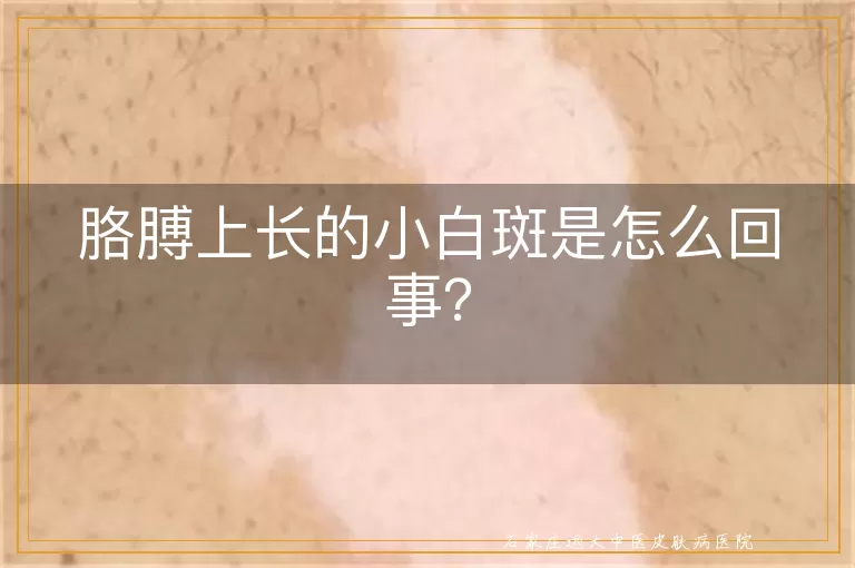 胳膊上长的小白斑是怎么回事？