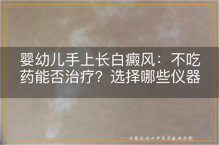 婴幼儿手上长白癜风：不吃药能否治疗？选择哪些仪器？