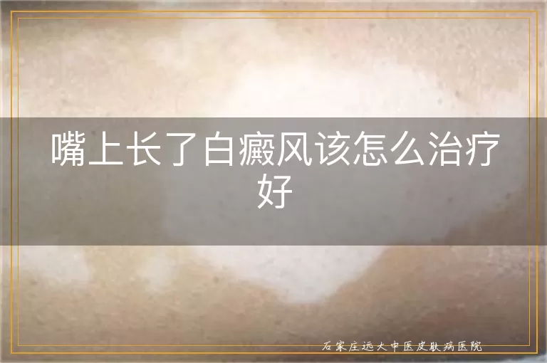 嘴上长了白癜风该怎么治疗好