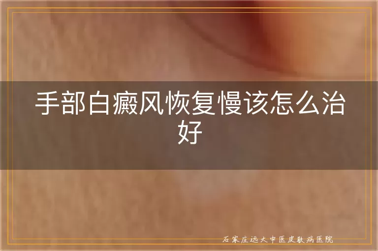 手部白癜风恢复慢该怎么治好