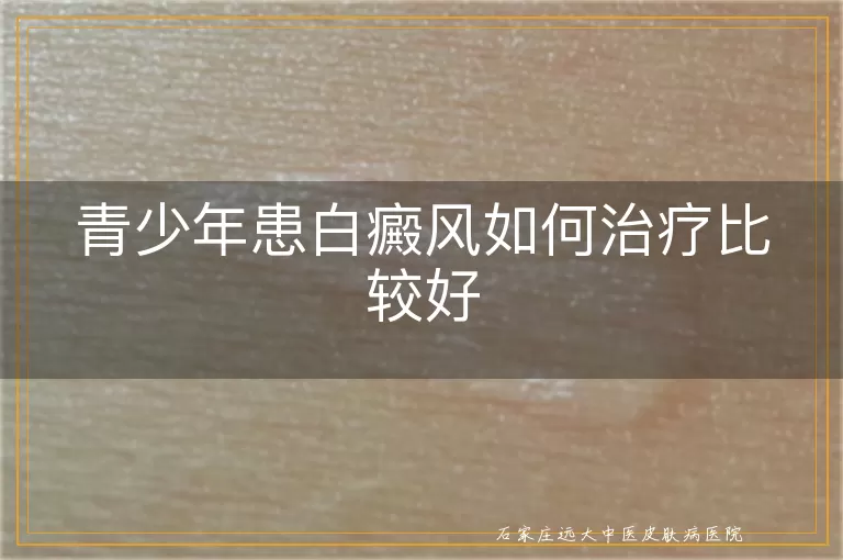 青少年患白癜风如何治疗比较好