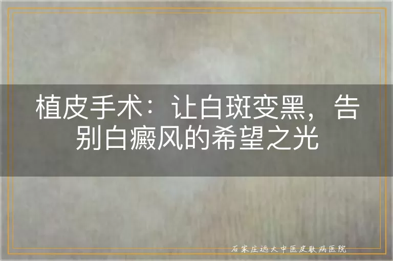 植皮手术：让白斑变黑，告别白癜风的希望之光