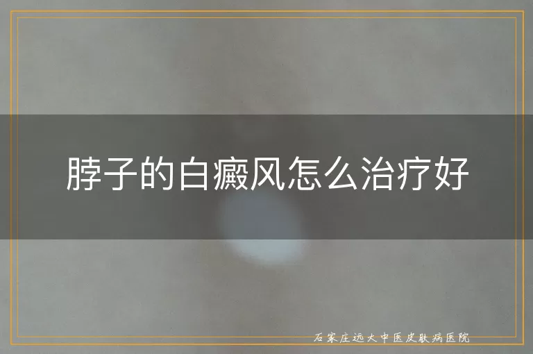脖子的白癜风怎么治疗好