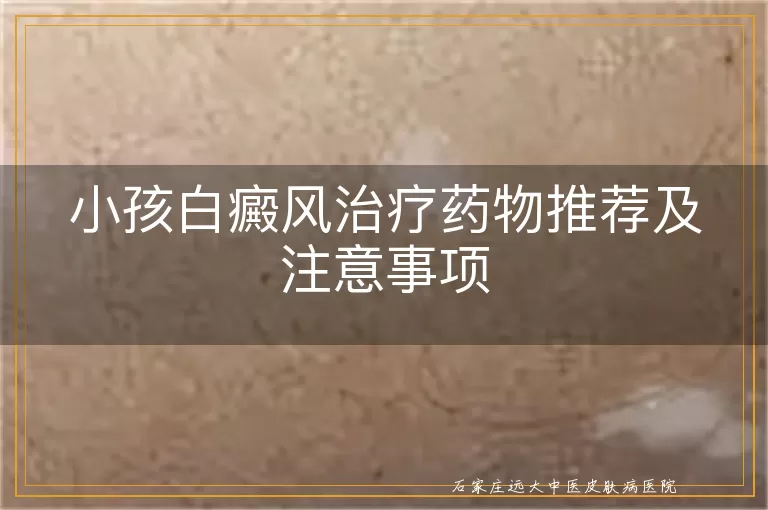 小孩白癜风治疗药物推荐及注意事项