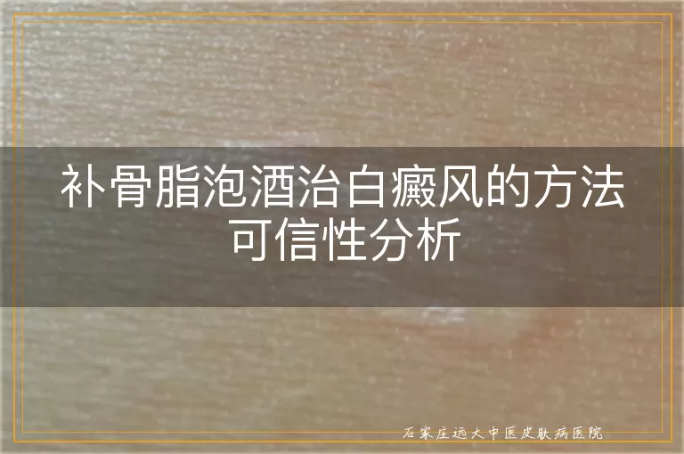 补骨脂泡酒治白癜风的方法可信性分析
