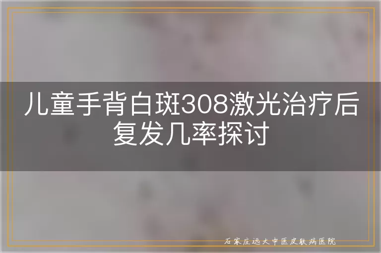 儿童手背白斑308激光治疗后复发几率探讨