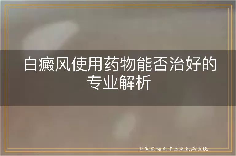 白癜风使用药物能否治好的专业解析