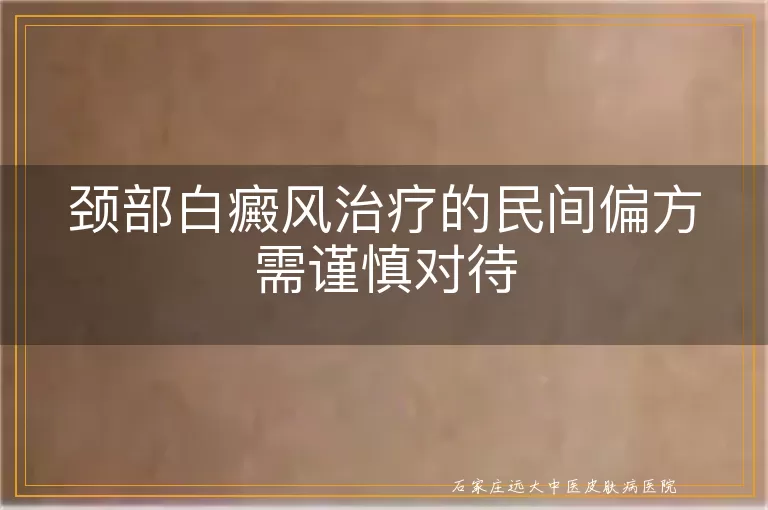 颈部白癜风治疗的民间偏方需谨慎对待