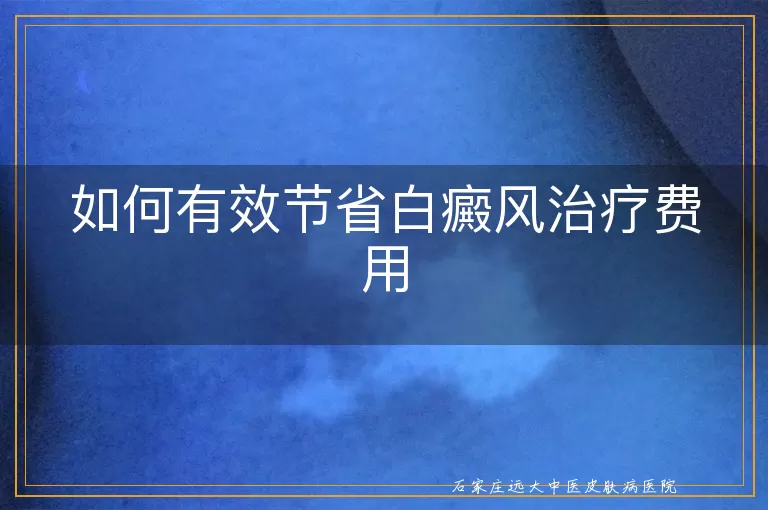 如何有效节省白癜风治疗费用