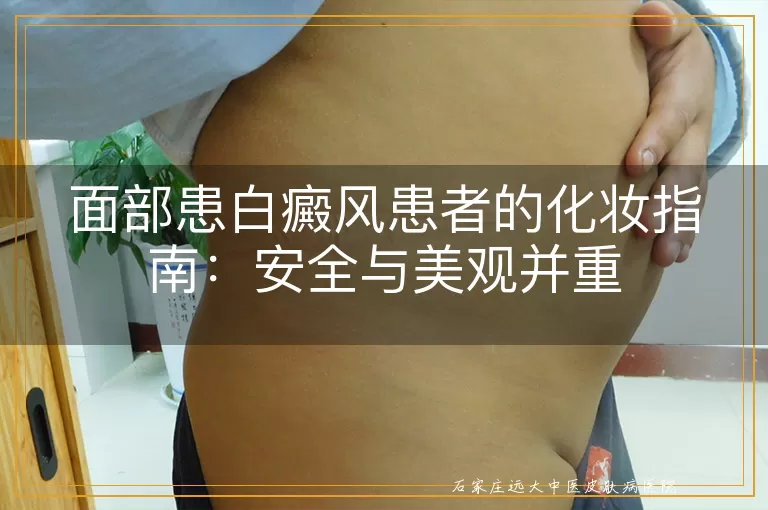 面部患白癜风患者的化妆指南：安全与美观并重