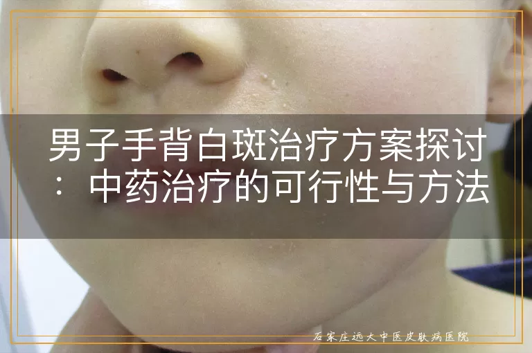 男子手背白斑治疗方案探讨：中药治疗的可行性与方法