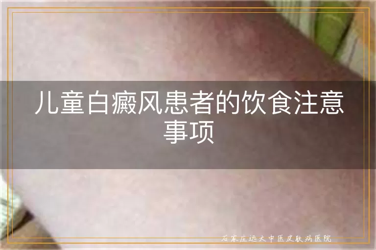 儿童白癜风患者的饮食注意事项