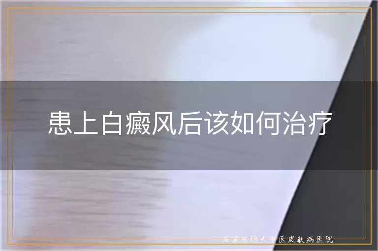 患上白癜风后该如何治疗