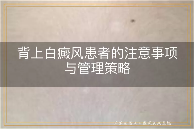 背上白癜风患者的注意事项与管理策略