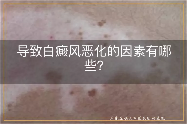 导致白癜风恶化的因素有哪些？