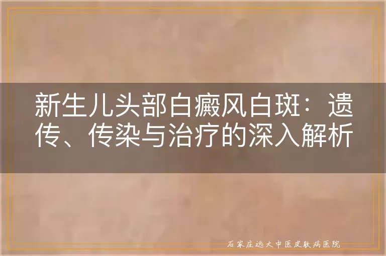 新生儿头部白癜风白斑：遗传、传染与治疗的深入解析