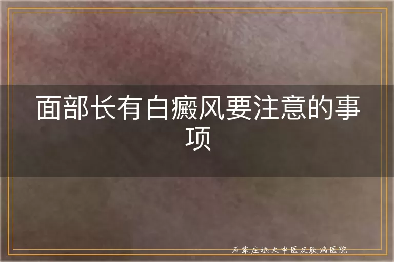 面部长有白癜风要注意的事项