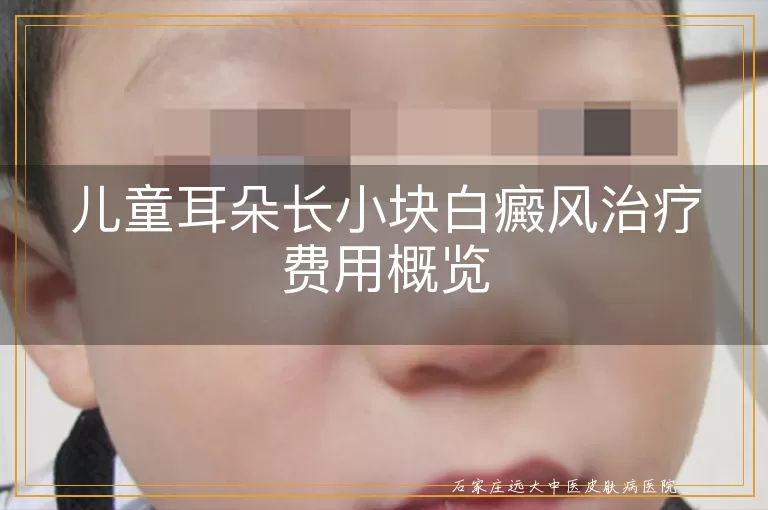 儿童耳朵长小块白癜风治疗费用概览