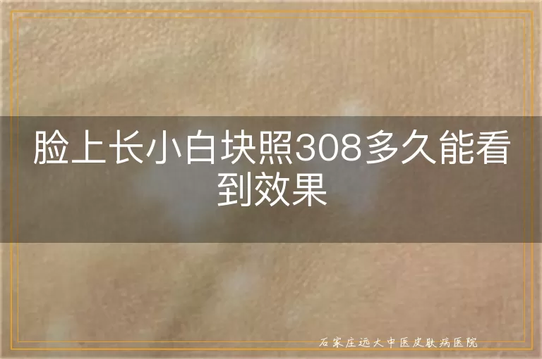 脸上长小白块照308多久能看到效果