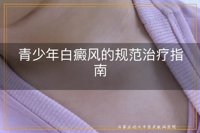 青少年白癜风的规范治疗指南